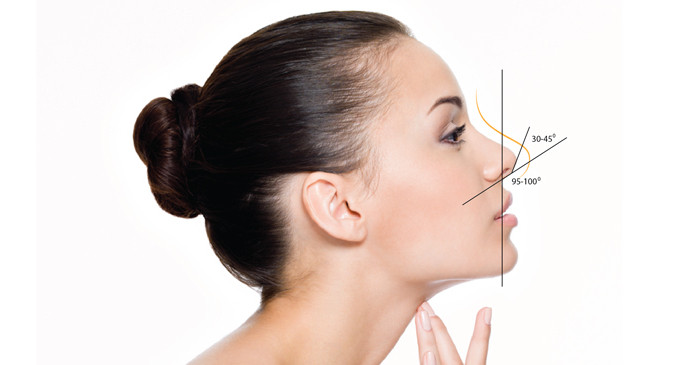 BẠN BIẾT GÌ VỀ PHẪU THUẬT NÂNG MŨI?