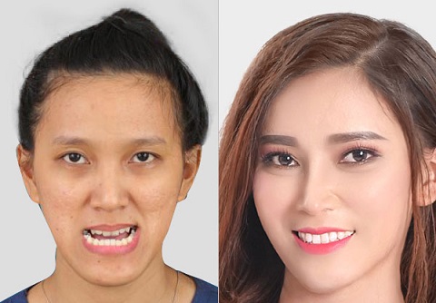 Thẩm mỹ hàm mặt